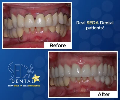 Seda Dental Before and After Images