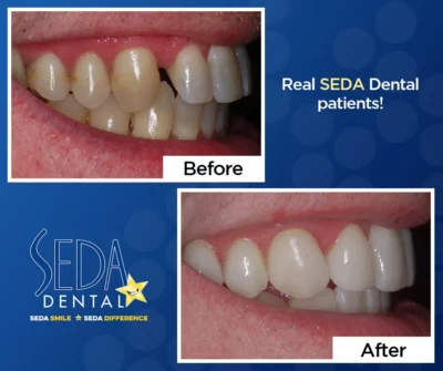 Seda Dental Before and After Images