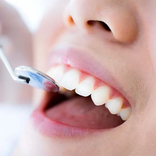 SEDA Dental Full Exam and X-rays