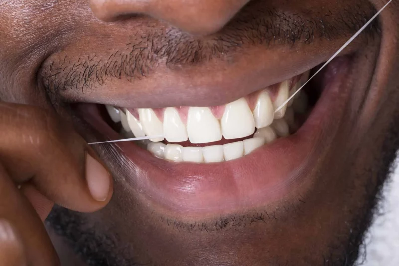 SEDA Dental will help with any Gum Disease
