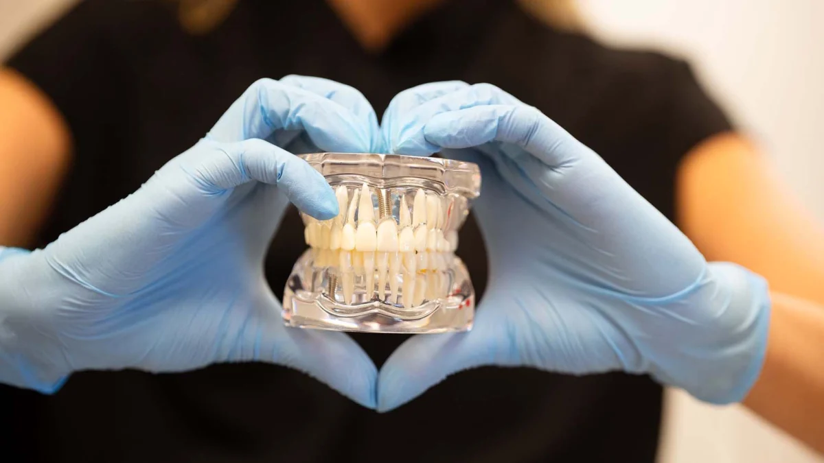 Seda dental smiles with Dental Implants